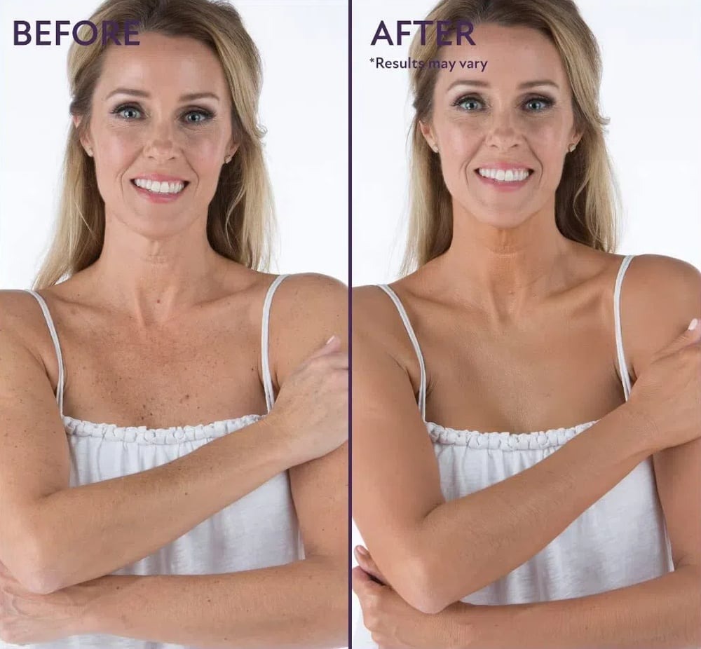 CoverUp™ | Flawless Skin Solution For Face & Body