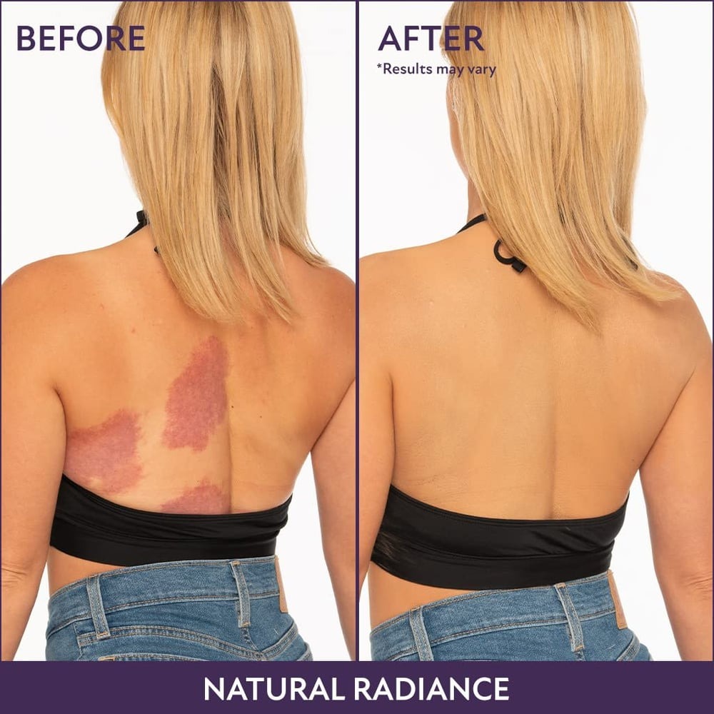 CoverUp™ | Flawless Skin Solution For Face & Body