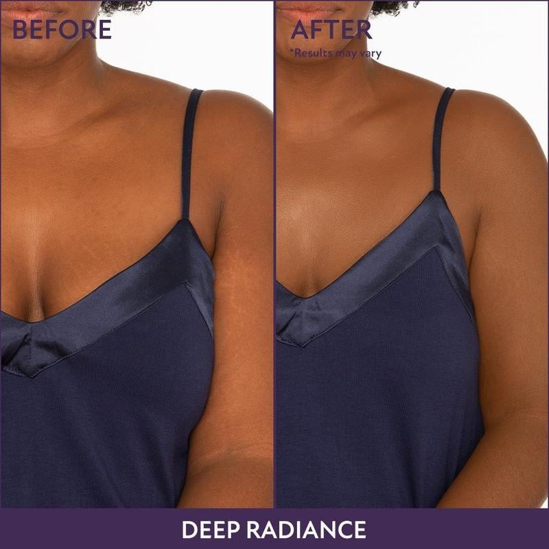 CoverUp™ | Flawless Skin Solution For Face & Body